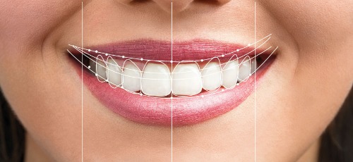 Smile Design: How Aesthetic Dentistry Transforms Your Confidence